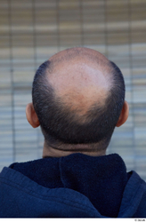 Head Hair Man White Casual Average Bald Street photo references